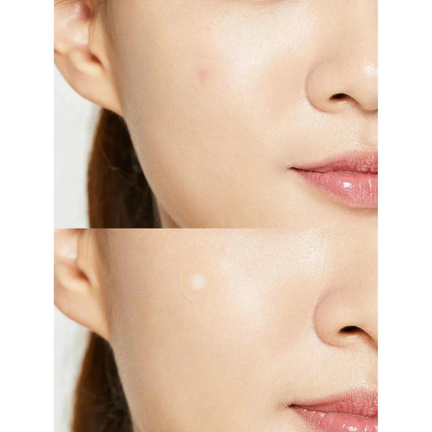 COSRX Acne Pimple Master Patch 24 Count