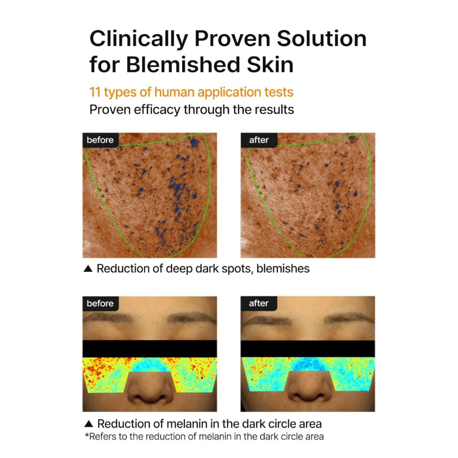 celimax Pore+Dark Spot Brightening Cream | with Niacinamide, Tranexamic Acid, TXA Cream, Pore Minimizer, Non-Irritating, Hydrating, For Sensitive Skin, 35ml