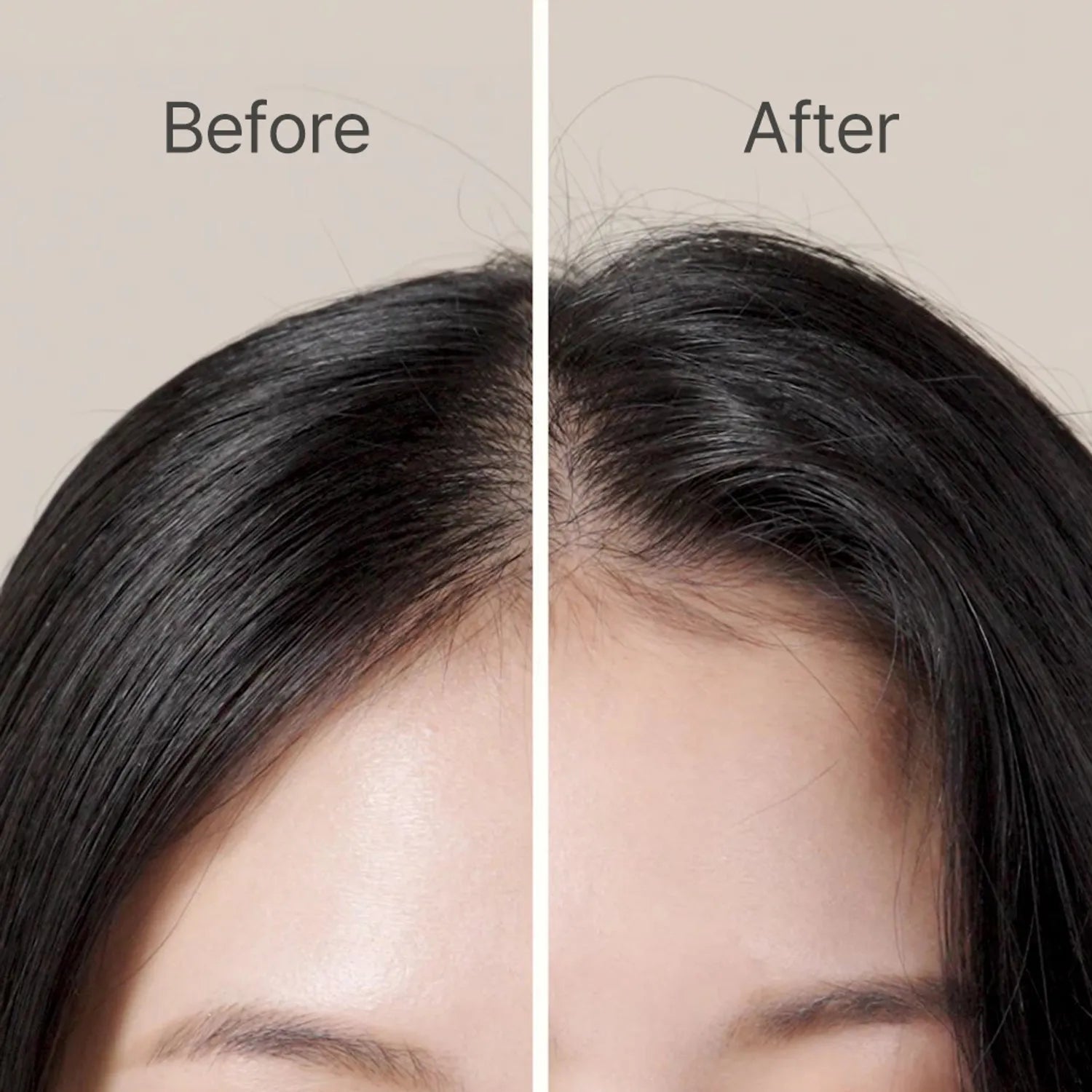 Ryo Root:Gen Hair Volume Filler 150ml Exclusive Set (+Shampoo 100ml)