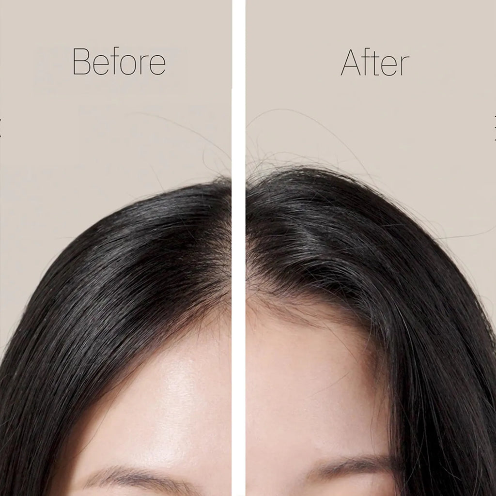 Ryo Root:Gen Scalp Care Shampoo for women 353mL Double Pack