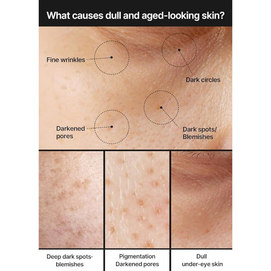 celimax Pore+Dark Spot Brightening Cream | with Niacinamide, Tranexamic Acid, TXA Cream, Pore Minimizer, Non-Irritating, Hydrating, For Sensitive Skin, 35ml