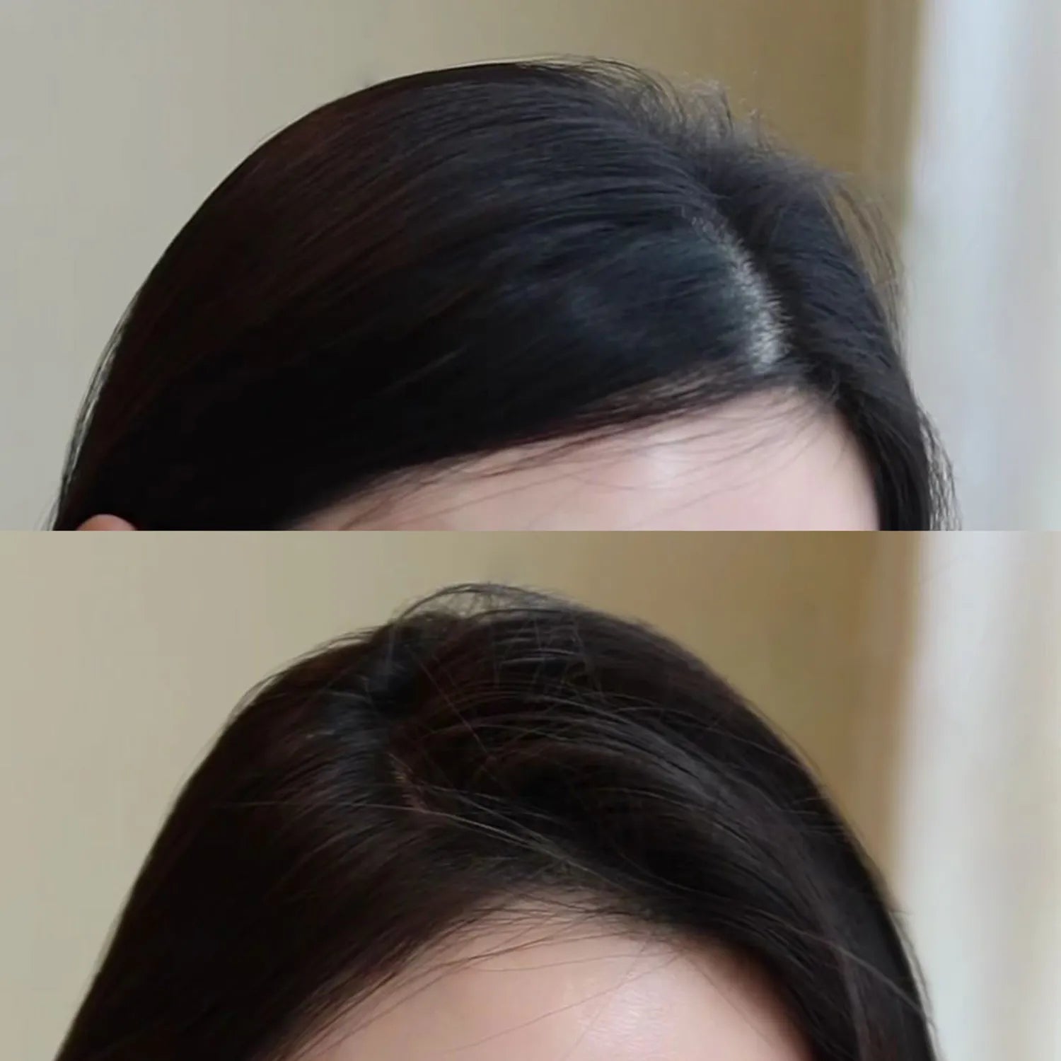 Ryo Root:Gen Hair Volume Filler 150ml Exclusive Set (+Shampoo 100ml)