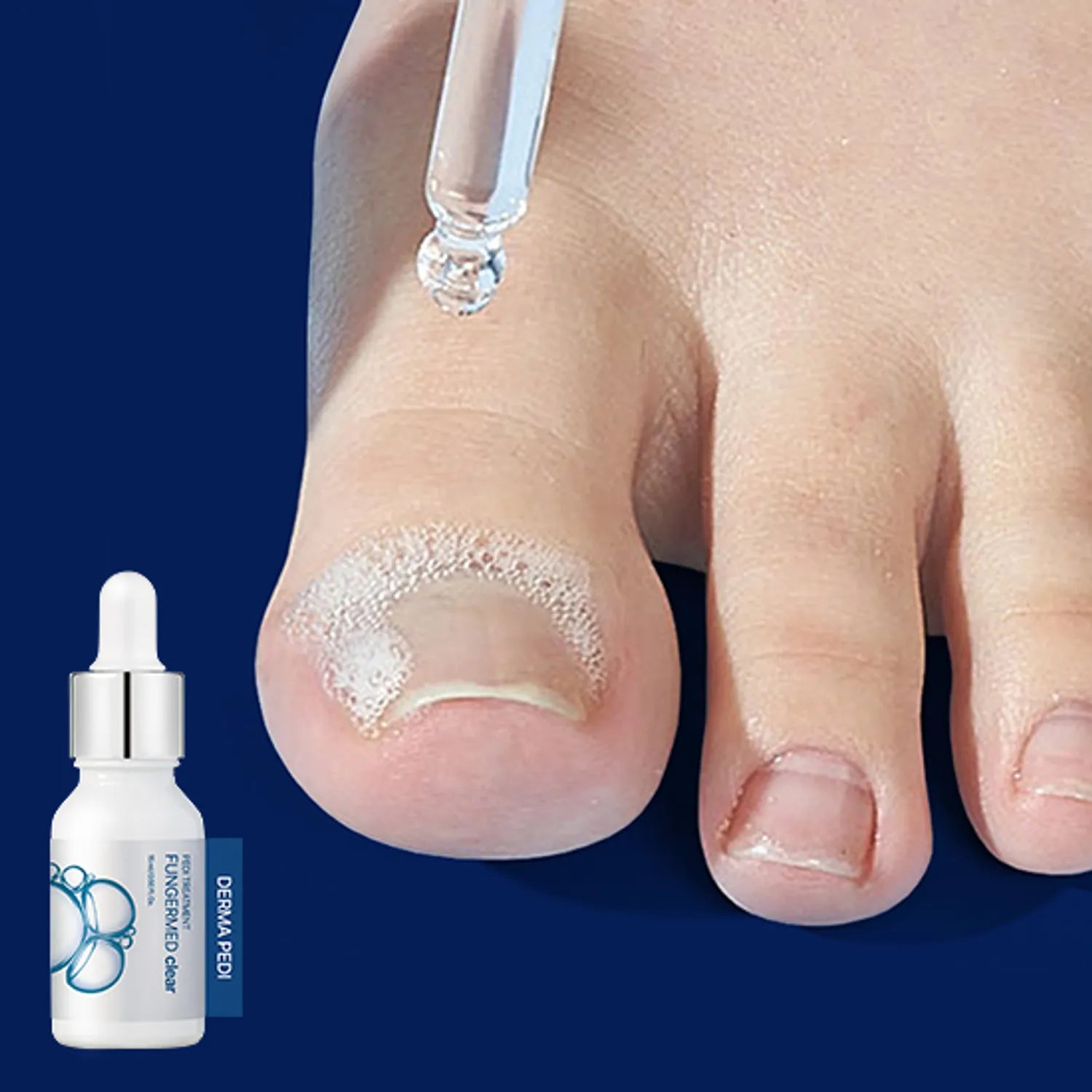 BANDI Derma Pedi Care 3Type