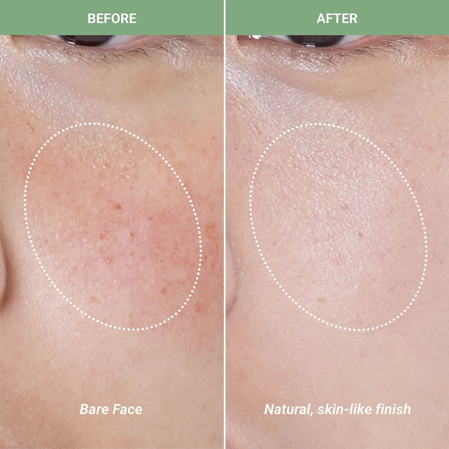 Meebak Cica Redness Solution Cream 50ml