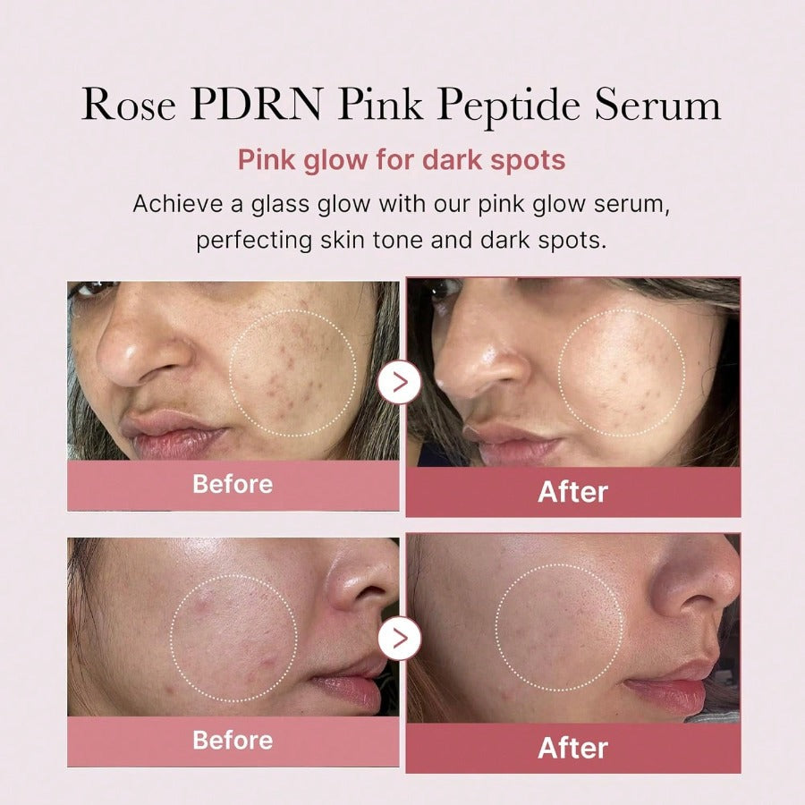 Medicube PDRN Pink Peptide Serum 30ml/1.01 Oz, Pink Glow Serum, Peptide, Niacinamide, Hydrating & Moisturizing & Firming, Uneven Skin Tone, Korean Skincare